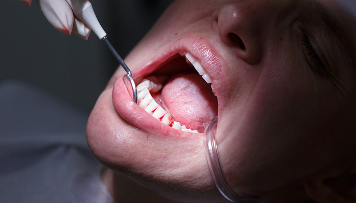 gum-disease-dentist