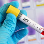 HIV Prevention Has Stalled Says CDC
