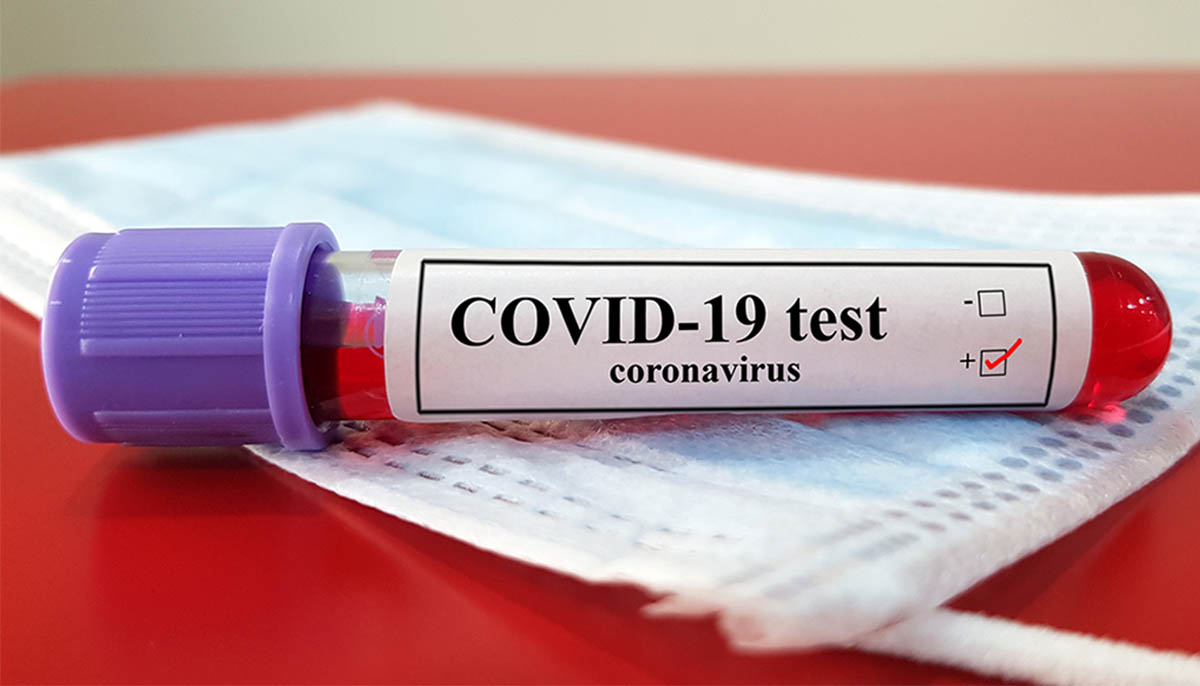 coronavirus antibody test